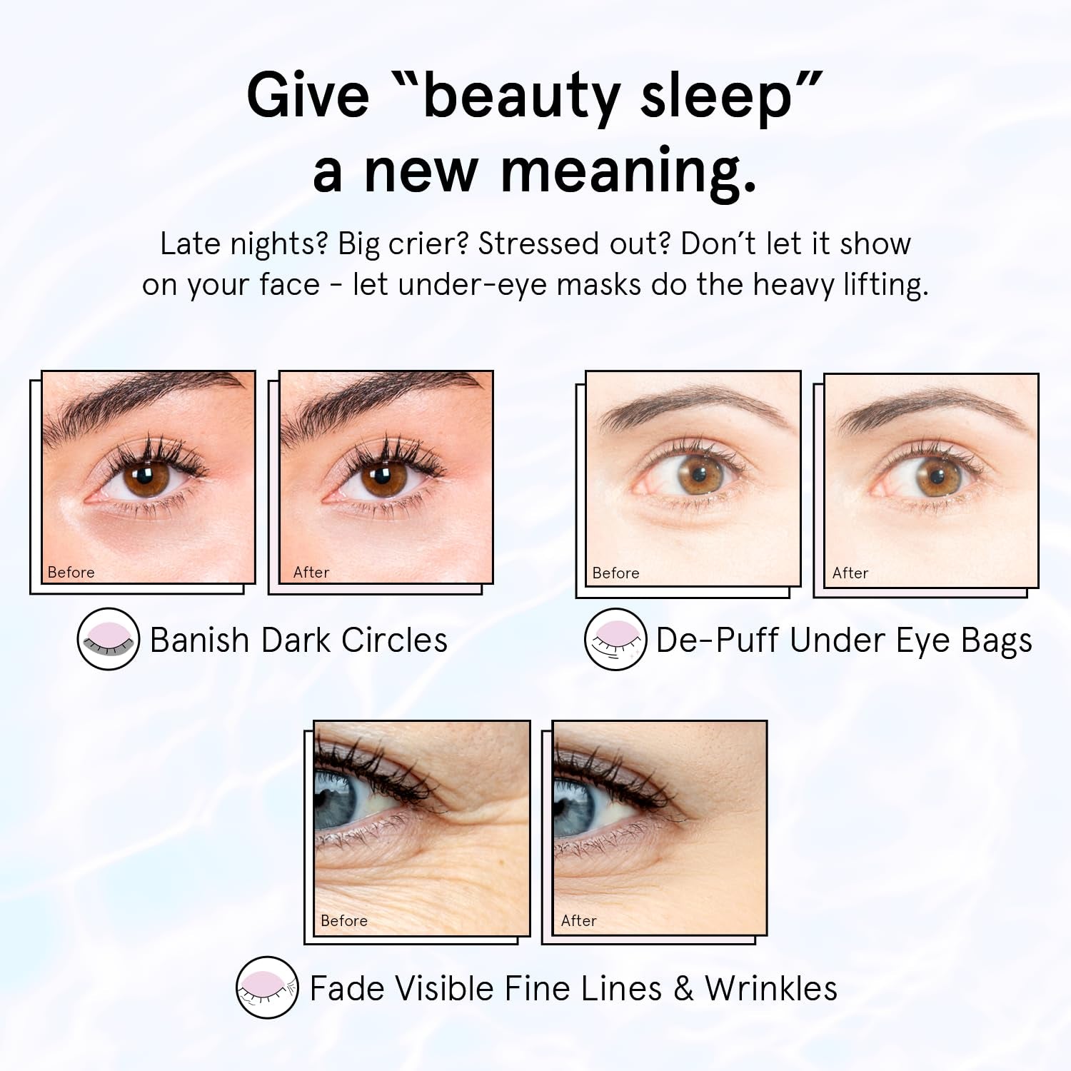 under Eye Patches for Puffy Eyes and Dark Circles (Retinol, 24 Pairs) Restoring Gel under Eye Masks with Hyaluronic Acid - Vegan Cruelty-Free Skincare Birthday Gifts for Women